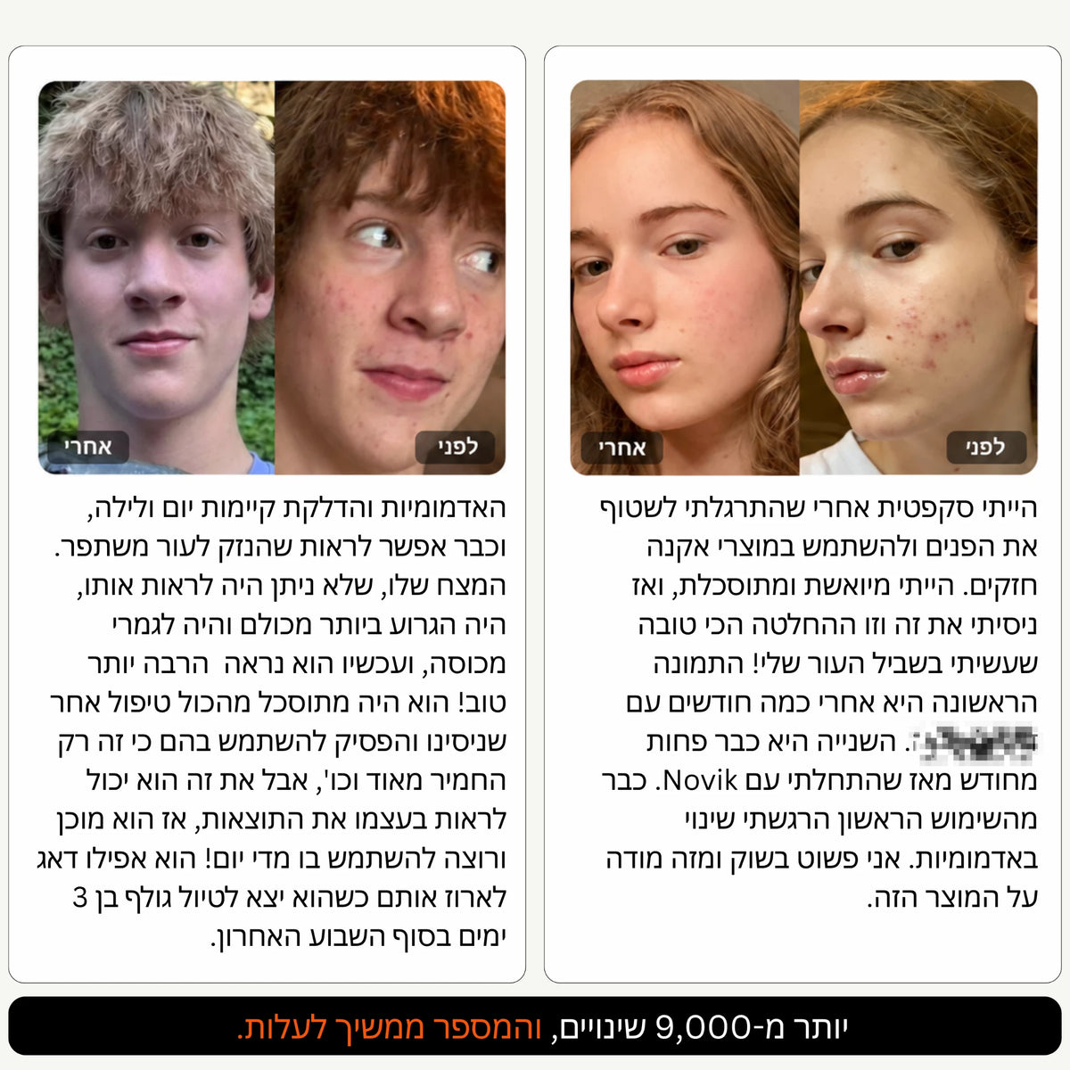NORVIK | הערכה המלאה לעור הנוטה לאקנה