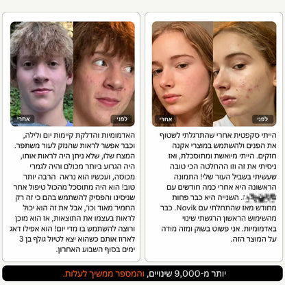 NORVIK | הערכה המלאה לעור הנוטה לאקנה